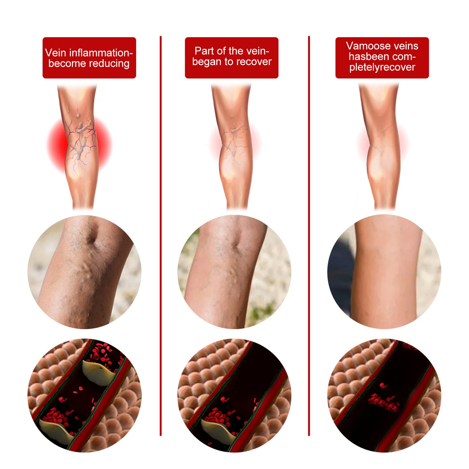 South Moon Herbal Patch for Leg Pain Relief and Care